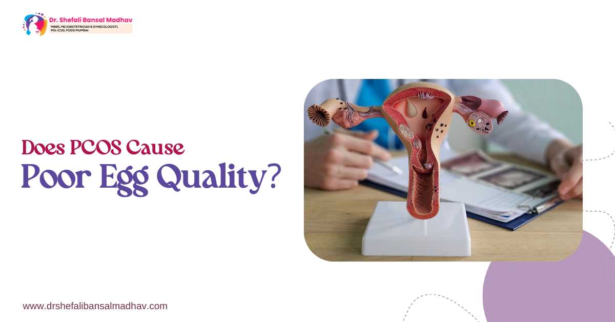 Does PCOS Cause Poor Egg Quality?