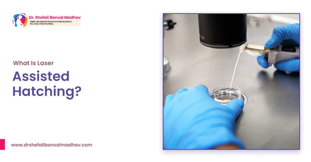 best infertility Specialist in Siliguri