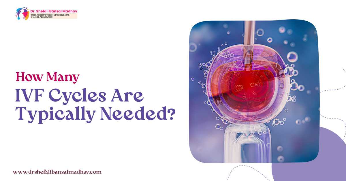 How Many IVF Cycles are Typically Needed