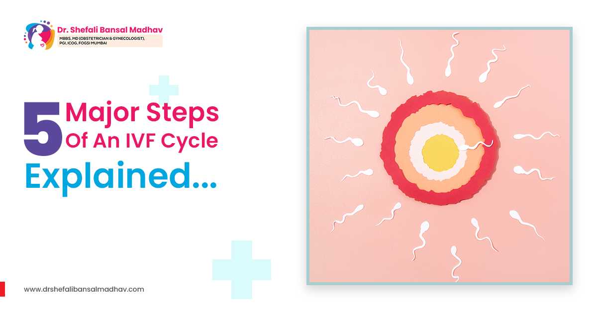 IVF Specialist in Siliguri