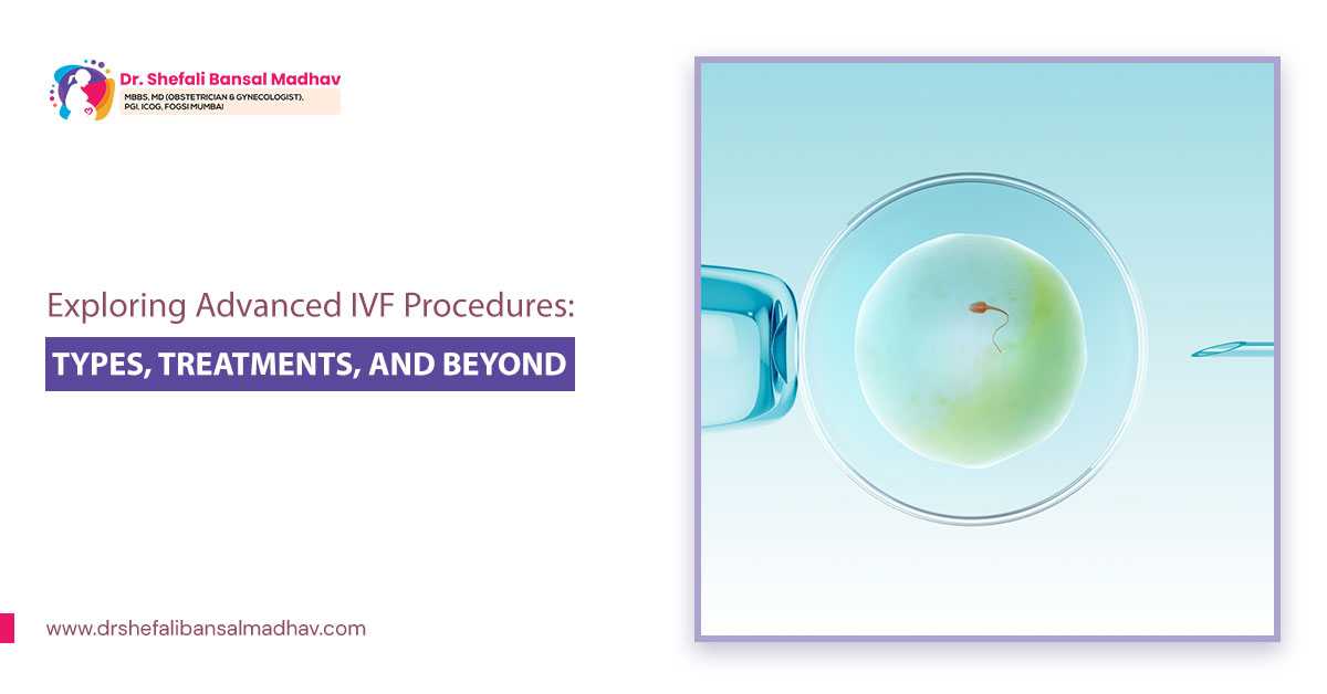 ivf specialist in Siliguri