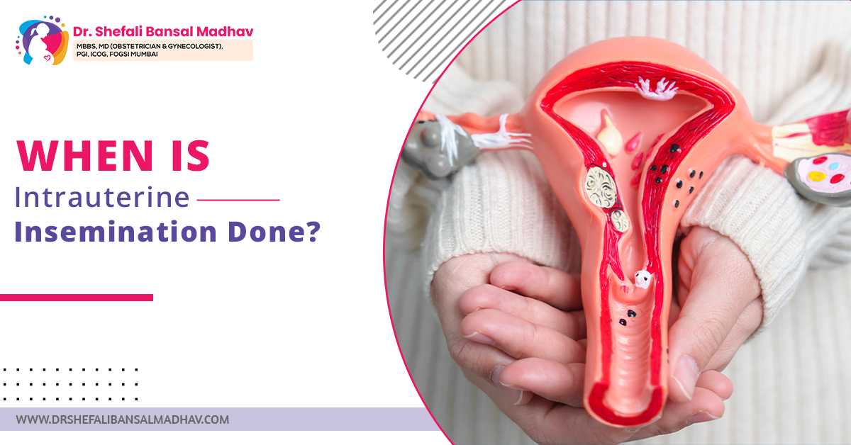 When Is Intrauterine Insemination Done?