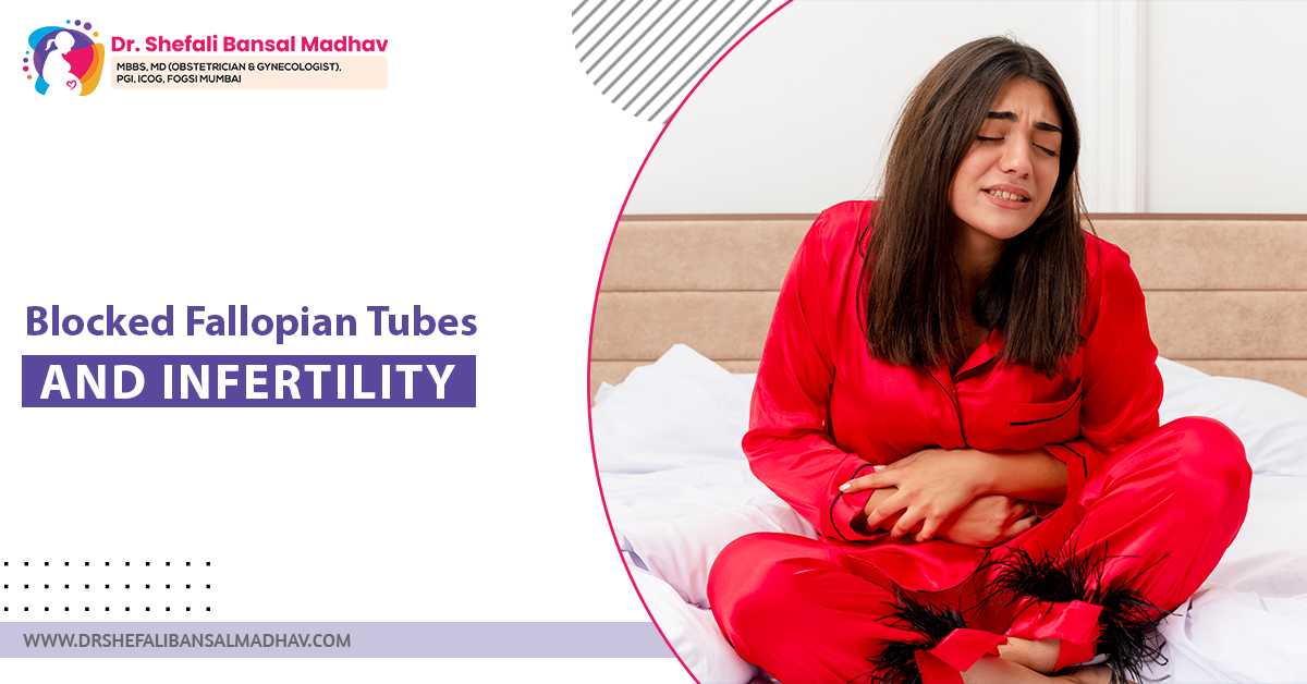 Blocked Fallopian Tubes and Infertility