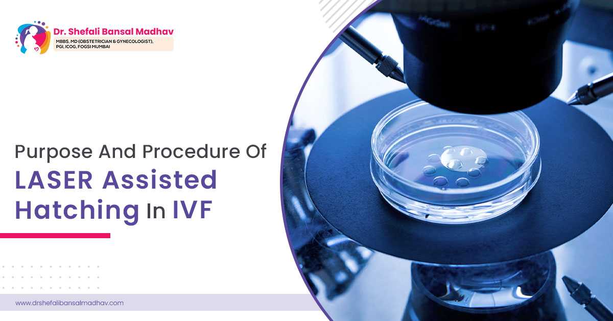 IVF in Siliguri