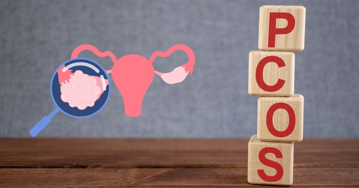 Pcos - DR. SHEFALI BANSAL MADHAV Blog